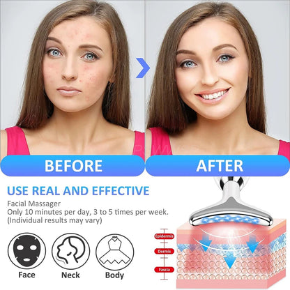Intense Pulsed Light Wrinkles Reducing Instrument